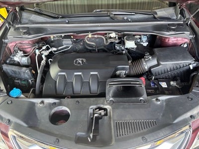 2017 Acura RDX Technology Package